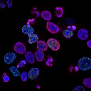 HPLC – High Performance Liquid Chromatography